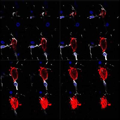 The Role of Microglia in the Spread of Tau: Relevance for Tauopathies